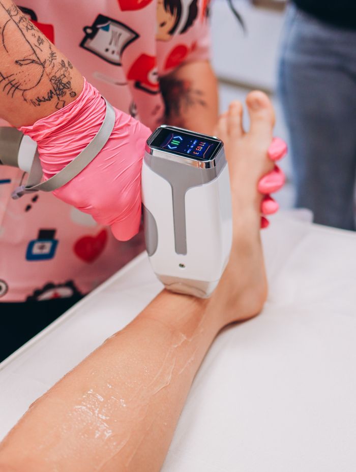 Close-up of a laser hair removal procedure on a client's leg, showcasing modern beauty treatment.